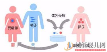 試管嬰兒具體流程(圖1)