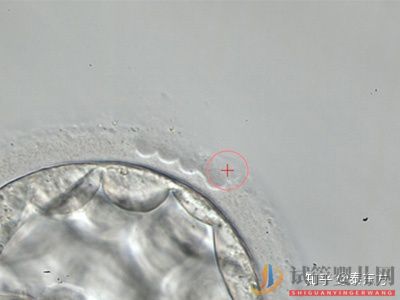 試管嬰兒成功必備的自身?xiàng)l件有什么？(圖1)