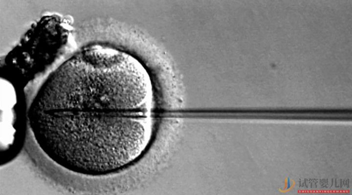 試管嬰兒可以報銷了,你可能需要這篇輔助生(圖7)