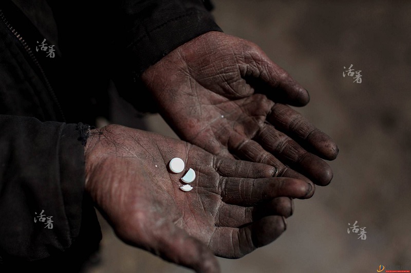 成都治療塵肺病費用大概多少(圖1)