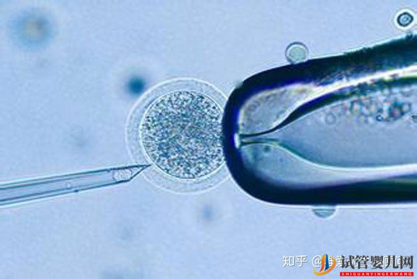 日喀則供卵試管嬰兒流程需要多久_進周期間可以正常上班嗎(圖1)