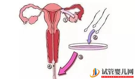 成功的女人,花50萬做試管嬰兒,試管過程你得知道(圖12)