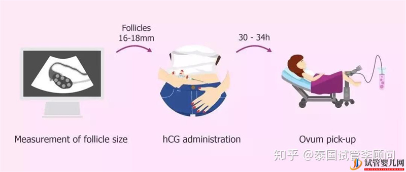 淄博試管嬰兒怎么做的全過程_試管嬰兒具體流程(圖1)