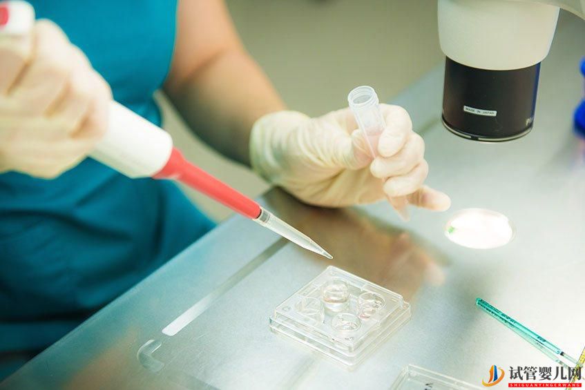 試管嬰兒取卵的過程！(圖2)