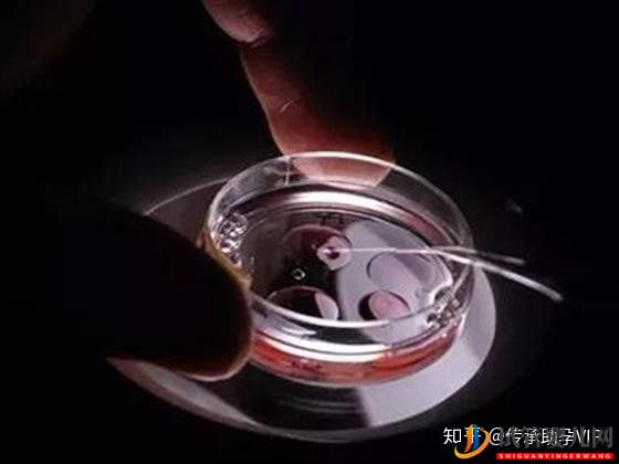 烏海試管嬰兒全過(guò)程需要多少時(shí)間(圖2)