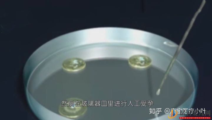 做試管嬰兒有多痛,幾張3D模擬圖,看完全過程后心(圖6)