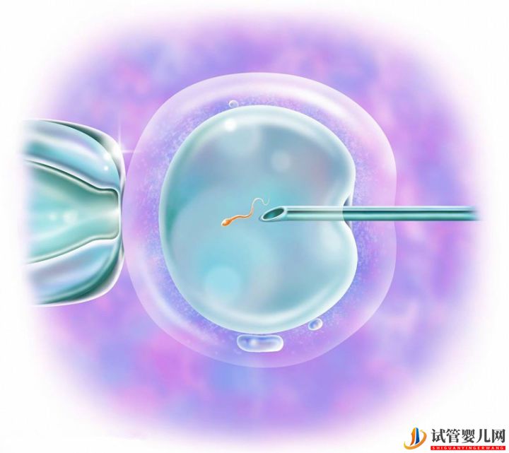 最全面的試管嬰兒介紹(圖2)