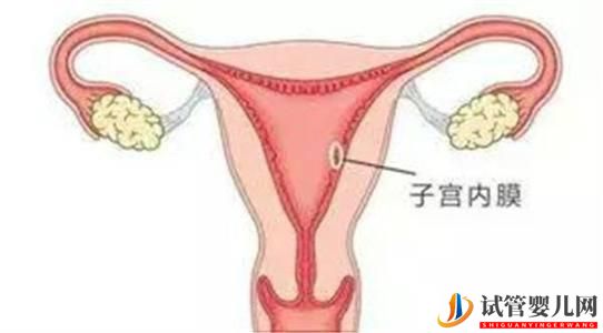 做俄羅斯試管嬰兒需要調理內膜嗎？調內膜一般要多少天(圖1)