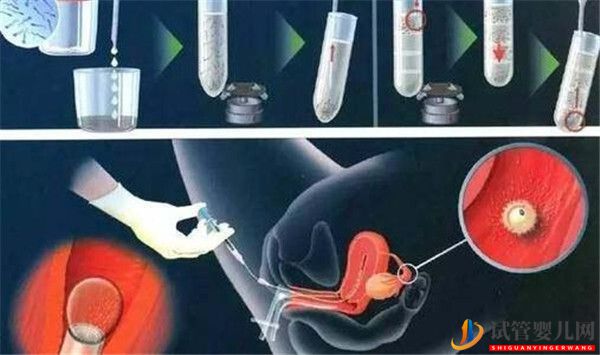 試管嬰兒移植成功率和移植的胚胎多少有關系么_移植后需要注意哪些(圖1)