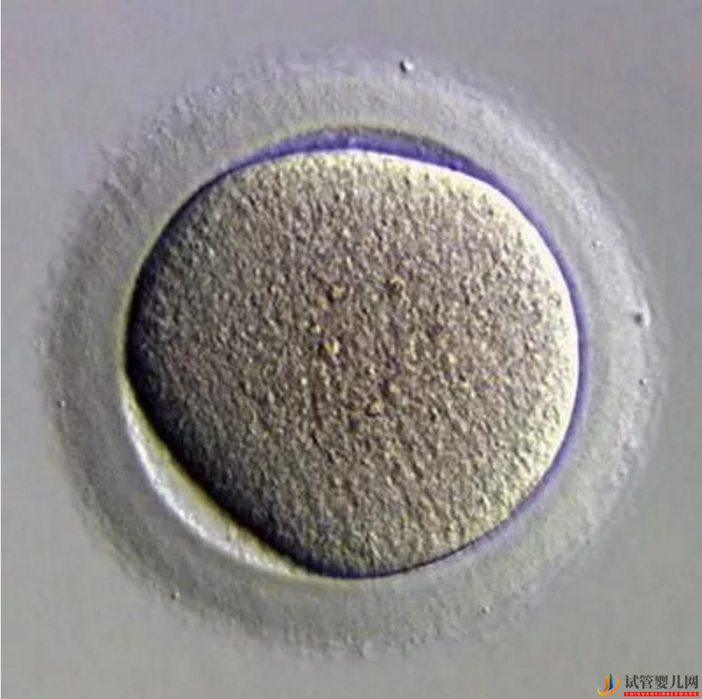 做試管嬰兒促排卵是一種什么樣的體驗？(圖1)