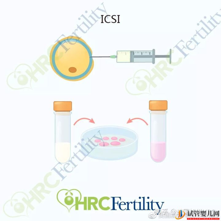 原來美國試管是這樣的美國試管(圖7)