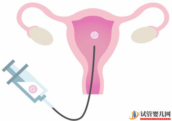 美國試管專家提高試管成功率的有效方案(圖10)