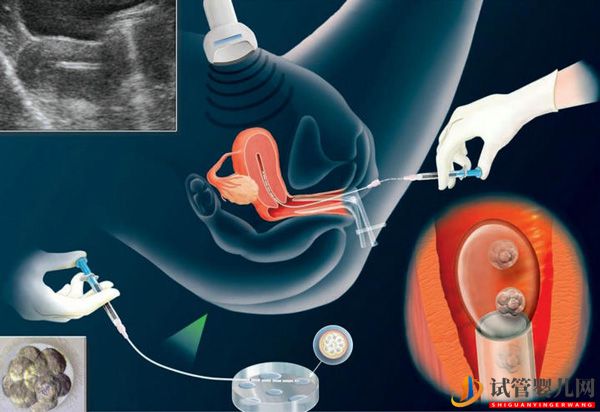 美國試管嬰兒凍胚能保存多久，影響寶寶未來的身體健康嗎？(圖1)