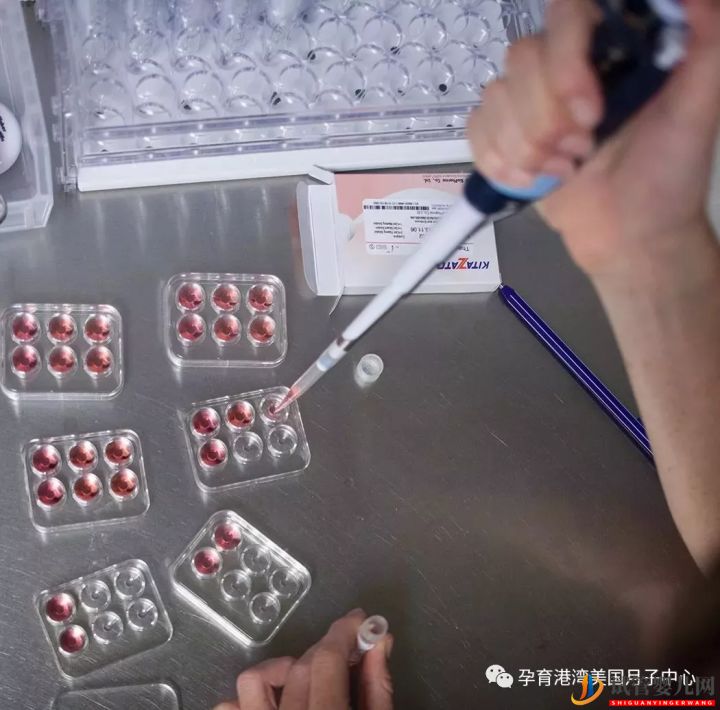 試管嬰兒技術,美國vs中國(圖4)
