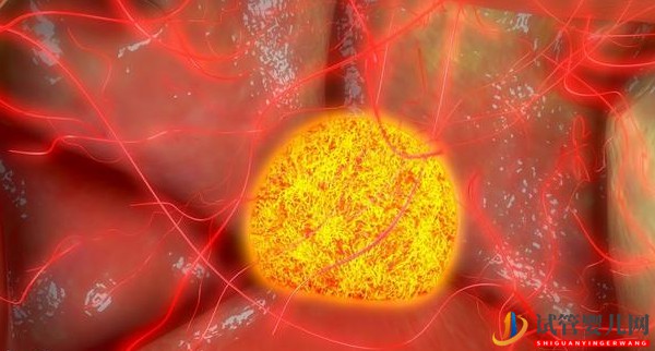 美國試管嬰兒成功率與卵泡數量、大小的關系(圖1)