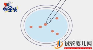 試管嬰兒促排和取卵(圖6)