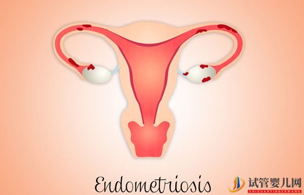 子宮內(nèi)膜厚度對(duì)美國(guó)試管嬰兒移植的影響，如何保養(yǎng)？(圖1)