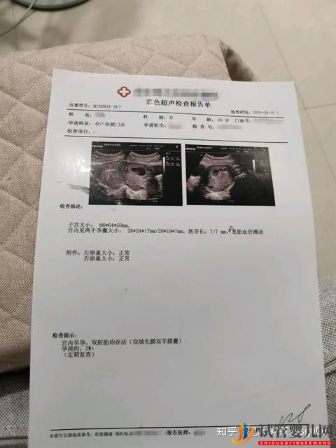 試管媽媽來教你_試管已生男孩的總結!(圖2)