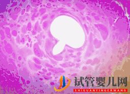 做試管嬰兒到底要花多少錢_幾萬和十幾萬有什么區別(圖12)