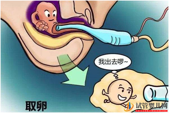 很多人都忽略了大齡做試管嬰兒的這些好處(圖1)