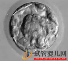 美國試管嬰兒_這樣的囊胚才是極好的(圖10)
