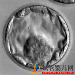 美國試管嬰兒_這樣的囊胚才是極好的(圖22)