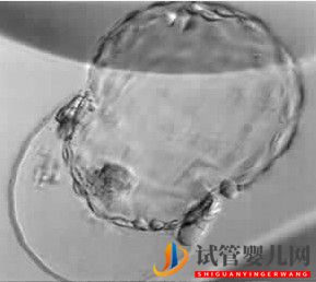 美國試管嬰兒_這樣的囊胚才是極好的(圖25)