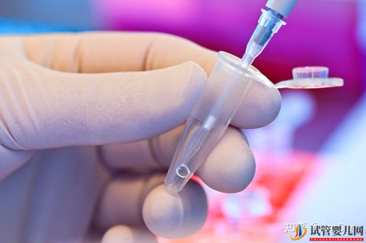 試管嬰兒大揭秘,取卵疼不疼(圖4)