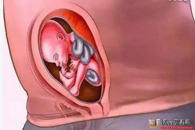 經痛赴美國做試管嬰兒有影響嗎(圖6)