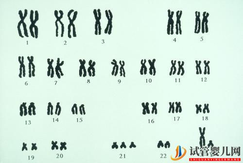 試管嬰兒網(wǎng):夫妻染色體正常,試管胚胎染色體異常的三個原因你都知道嗎?(圖2) 夫妻染色體正常,試管胚胎染色體異常的三個原因你都知道嗎?(圖1)