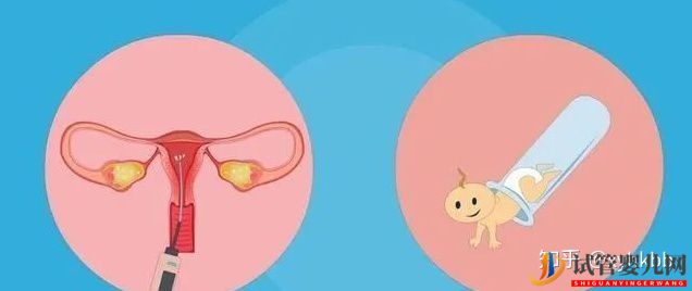 國內第三代試管嬰兒可以選擇性別嗎?(圖2)