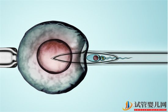 做試管嬰兒過程中需要在住院嗎(圖1)