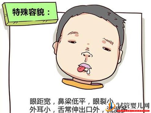 頭胎是唐氏兒，二胎備孕怎么預防唐氏？做三代試管可以預防嗎？(圖1)