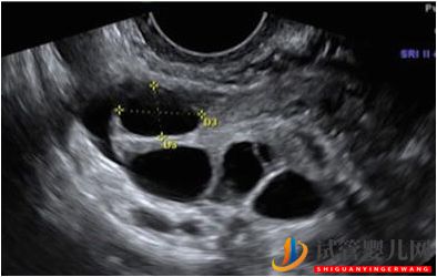 試管嬰兒卵子質量完整指南-卵子質量完整攻略(圖4)