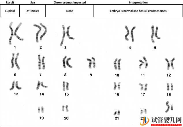 試管嬰兒卵子質量完整指南-卵子質量完整攻略(圖8)