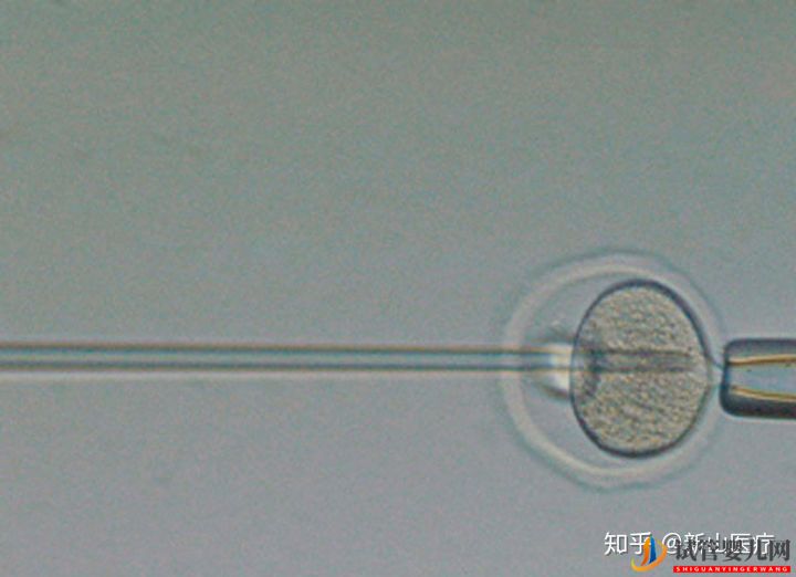 試管嬰兒幾代好一代、二代、三代先辨別清楚(圖2)