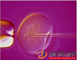 試管嬰兒幾代好一代、二代、三代先辨別清楚(圖5)