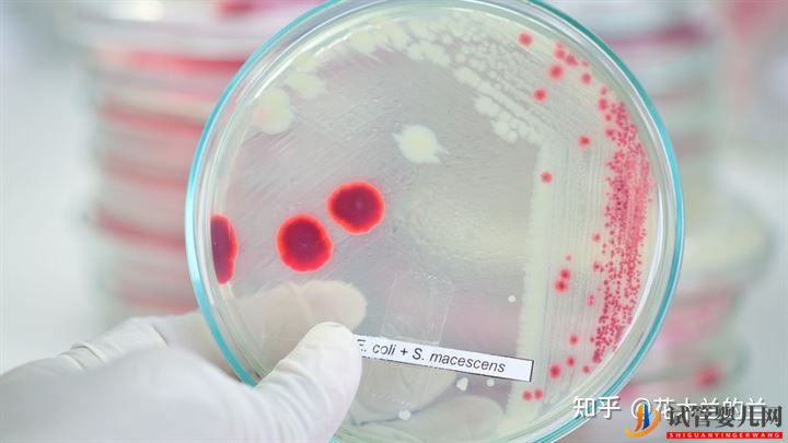 盤點試管嬰兒助孕前,必做檢查項目+注意事項!(圖7)