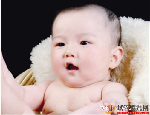 試管嬰兒雙胞胎的成功率是多少概率提升但不宜隨意選...(圖1)