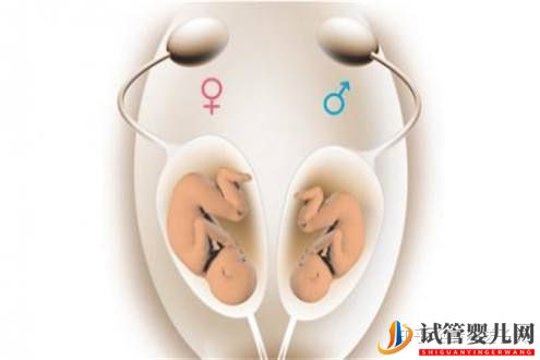 試管嬰兒懷雙胞胎幾率高嗎(圖1)