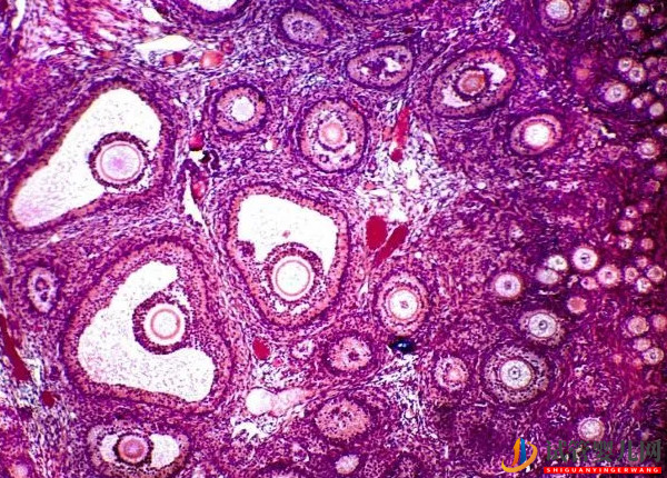 多囊、早衰都不是！這才是21個基礎卵泡降調變10個的原因(圖2)