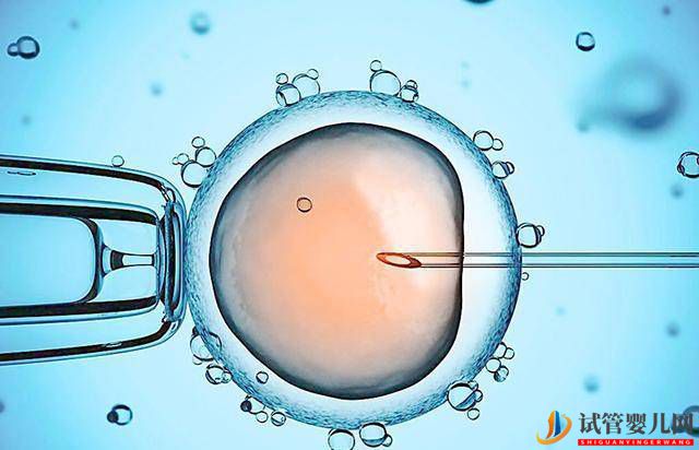 什么是試管嬰兒？并不是什么人都能做試管，決定前要先了解這些事(圖1)