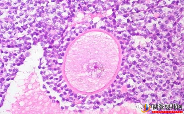 試管嬰兒網(wǎng):你知道嗎凍卵的難度到底在哪里(圖4) 你知道嗎凍卵的難度到底在哪里(圖3)