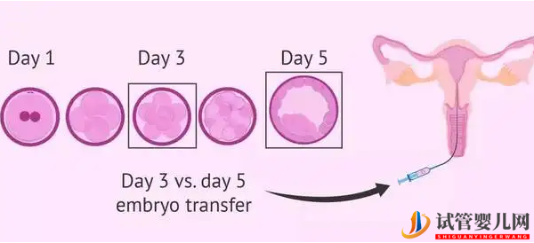 試管嬰兒在交通事故十日后流產,損失怎么賠(圖1)