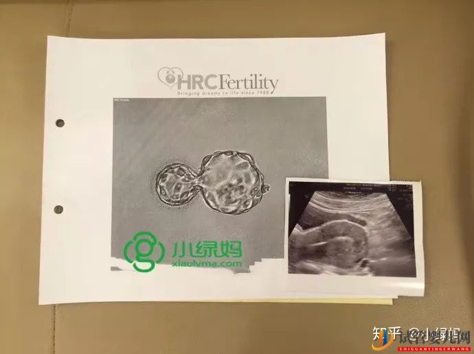 美國合法輔助生殖——流程及預算(圖4)