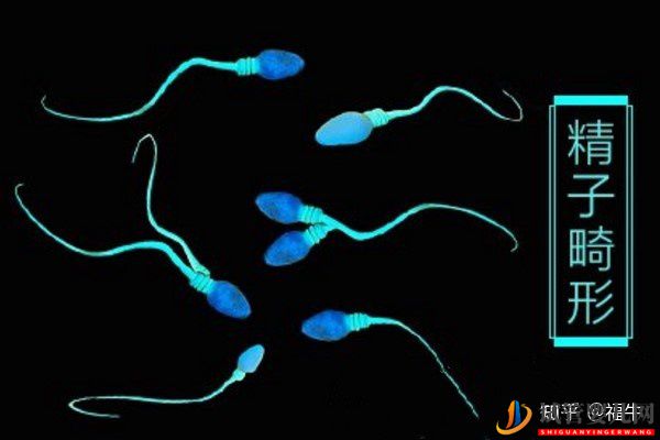 美國夢(mèng)美HRC試管專家解析三代試管嬰兒技術(shù)的優(yōu)缺...(試管嬰兒多少錢)(圖10) 美國HRC試管專家解析三代試管嬰兒技術(shù)的優(yōu)缺點(diǎn)(圖5)