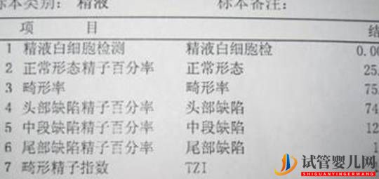 想要做試管嬰兒前我們需要了解哪些知識(圖1)