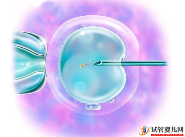 美國試管嬰兒的四大獨特優勢(圖3)