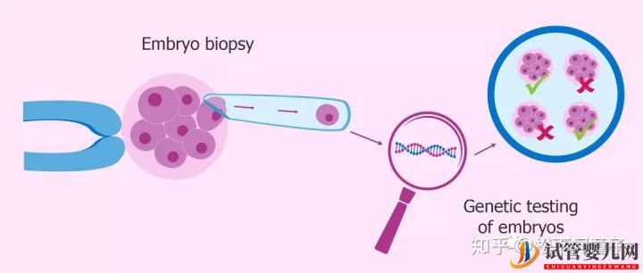 關于美國試管嬰兒技術的問題一網打盡(圖4)