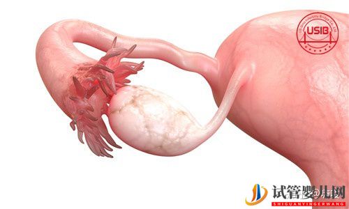 新手媽媽做美國試管嬰兒前一定要了解這些知識!(圖1)